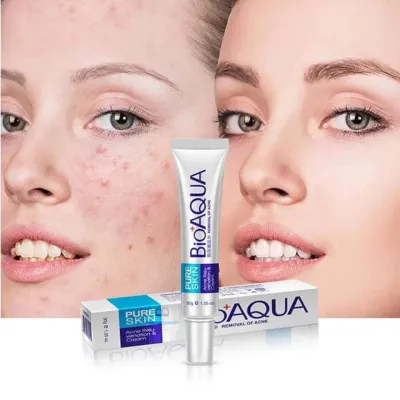 BIOAQUA Pure Skin ACNE Removal Cream (30gm)